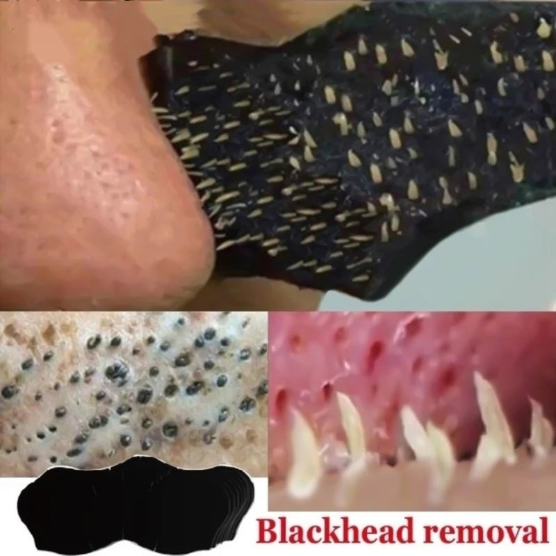 Blackhead Remover Nose Strips - Deep Cleansing Pore Strips