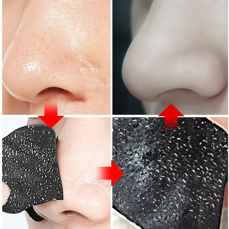 Blackhead Remover Nose Strips - Deep Cleansing Pore Strips